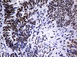 NBN / Nibrin Antibody (aa183-460, clone OTI2F5, Carrier-free)