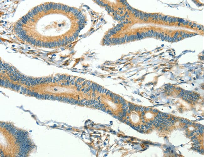 CAV3 / Caveolin 3 Antibody