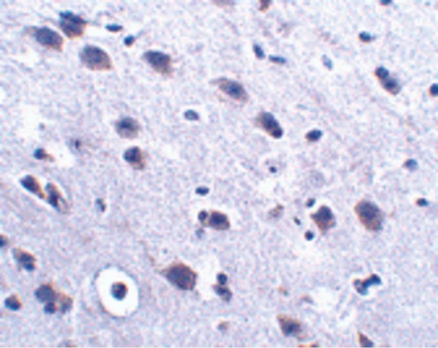 IHC-plus™ LRFN2 Antibody