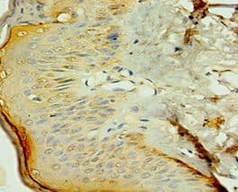NR2C2 / TAK1 Antibody (aa240-380)