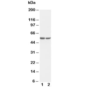 FOS / c-FOS Antibody (aa170-187)