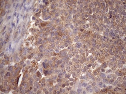 Vps60 / CHMP5 Antibody (clone OTI5C7)