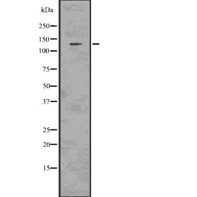 CARMA1 / CARD11 Antibody