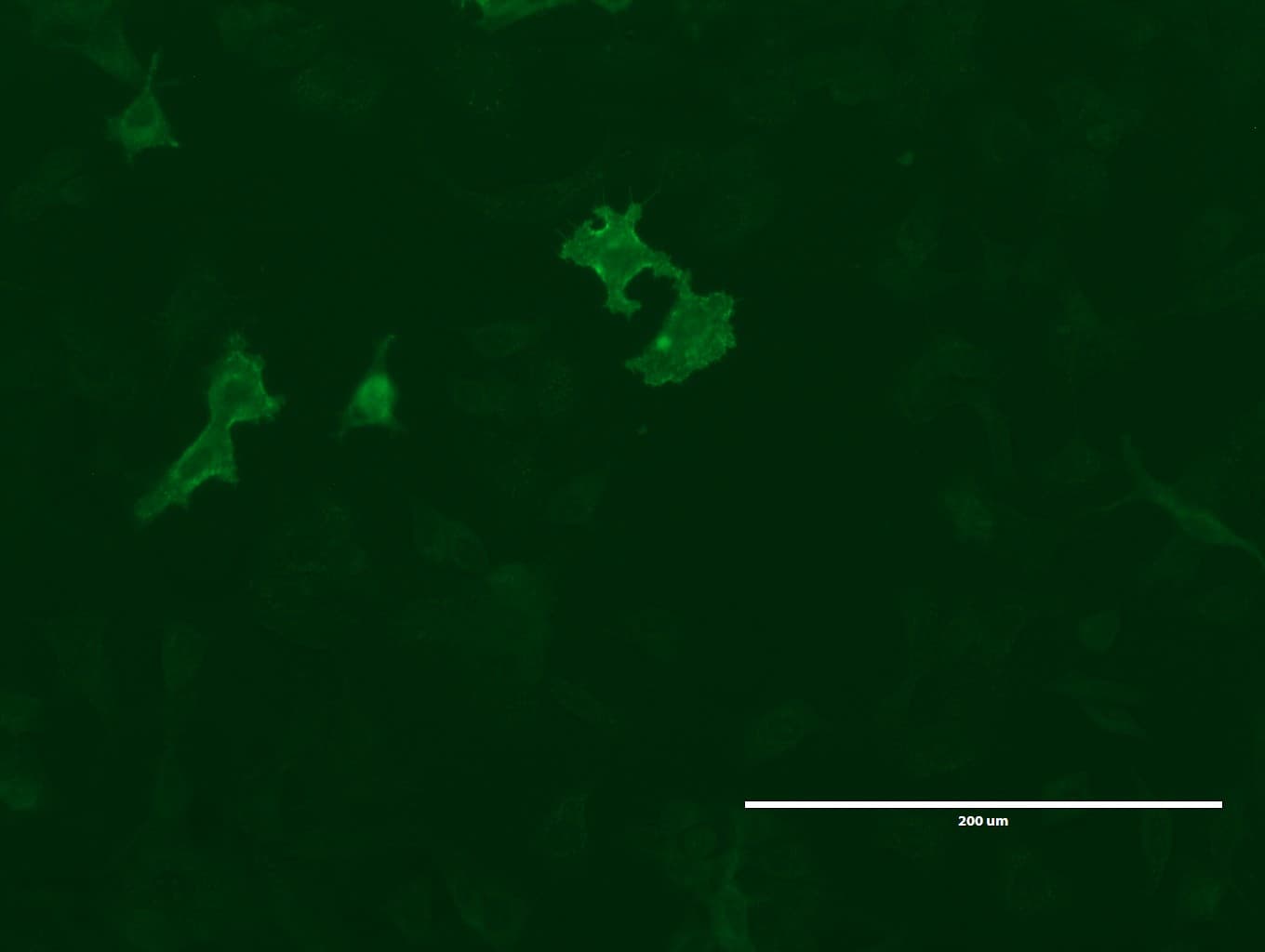 GPR49 / LGR5 Antibody (aa22-543, clone UMAB210)