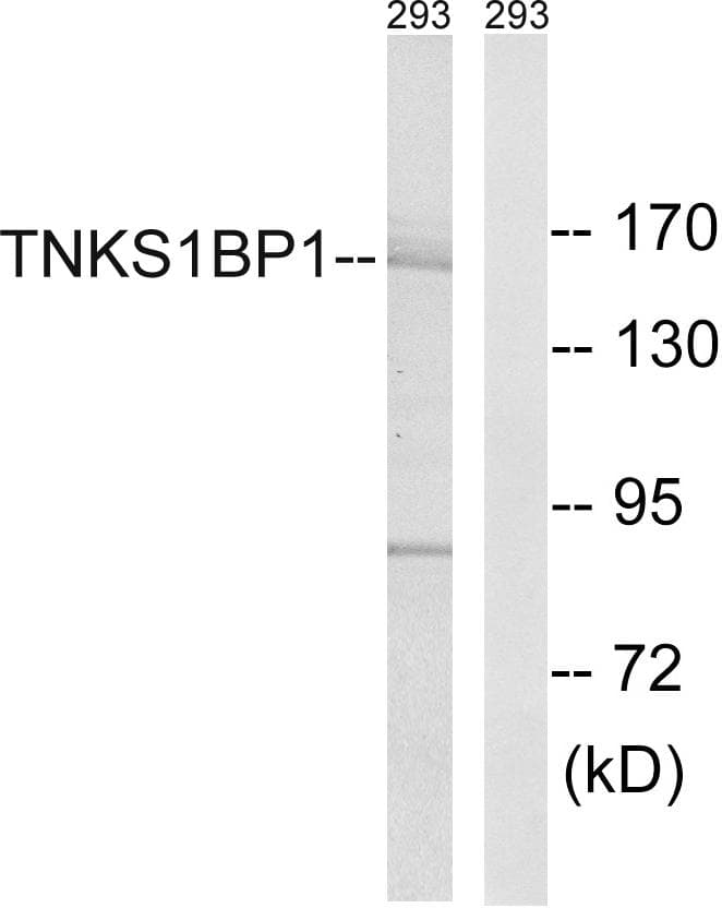 TNKS1BP1 / TAB182 Antibody