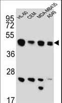 Polyclonal Rabbit anti-Human BIN2 Antibody (aa14-42, IHC, WB)