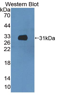 CCDC60 Antibody (aa1-186)