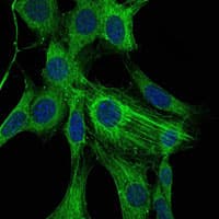 IHC-plus™ ACTA2 / Smooth Muscle Actin Antibody (clone 1H8)