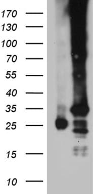 Monoclonal Mouse anti-Human C19orf52 Antibody (clone OTI3C5, aa100-260, WB)