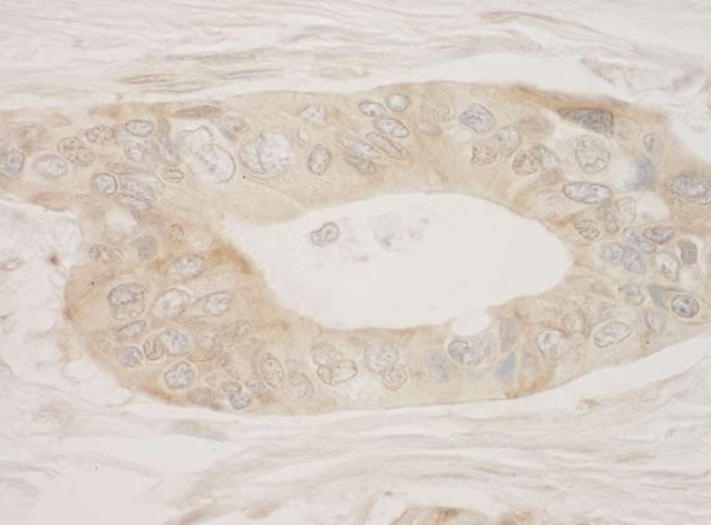RPS6KA3 / RSK2 Antibody (aa1-50)