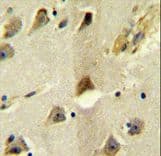 SLC12A5 / KCC2 Antibody (aa5-33)