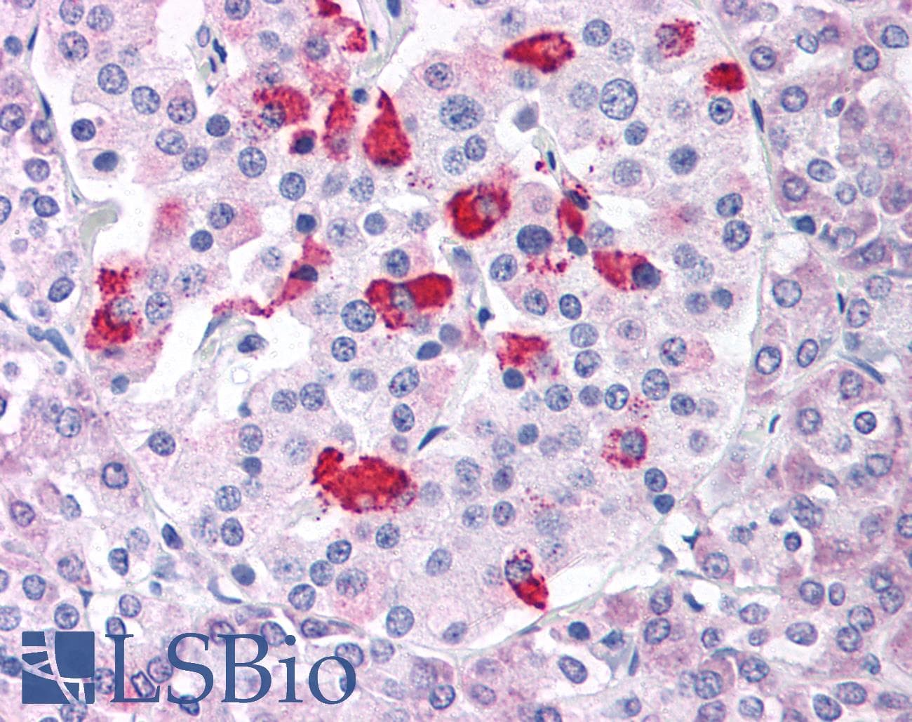 PathPlus™ Polyclonal Rabbit anti-Human BACE1 / BACE Antibody (Internal, IHC)