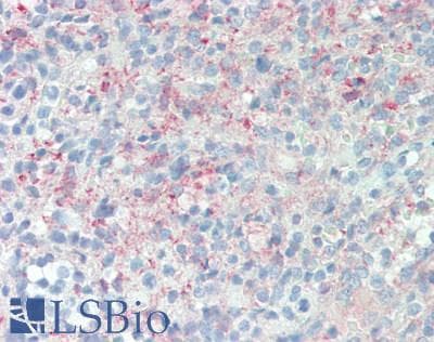 PDLIM2 / SLIM Antibody (clone OTI10C4)
