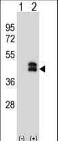 DUSP6 / MKP3 Antibody (aa59-88)
