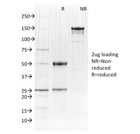 Monoclonal Mouse anti-Human SPI1 / PU.1 Antibody (clone PU1/2146, IHC, WB)