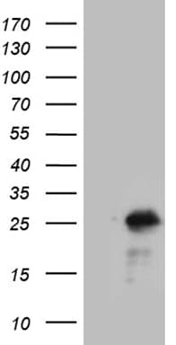 NCALD / Neurocalcin Delta Antibody (clone OTI6H3)