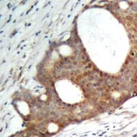 RPS6KL1 Antibody
