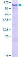 Human ASCC2 Protein (Recombinant GST)