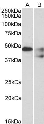 HTR1B / 5-HT1B Receptor Antibody (aa372-382)