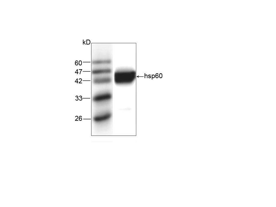Legionella pneumophila groL Antibody (aa72-478, clone BU-33)