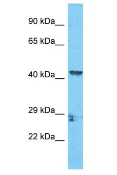 Polyclonal Rabbit anti-Human ZCCHC18 Antibody (aa324-373, WB)