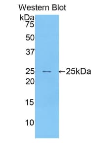 SIGLEC1 / CD169 / Sialoadhesin Antibody (aa34-240, Biotin)