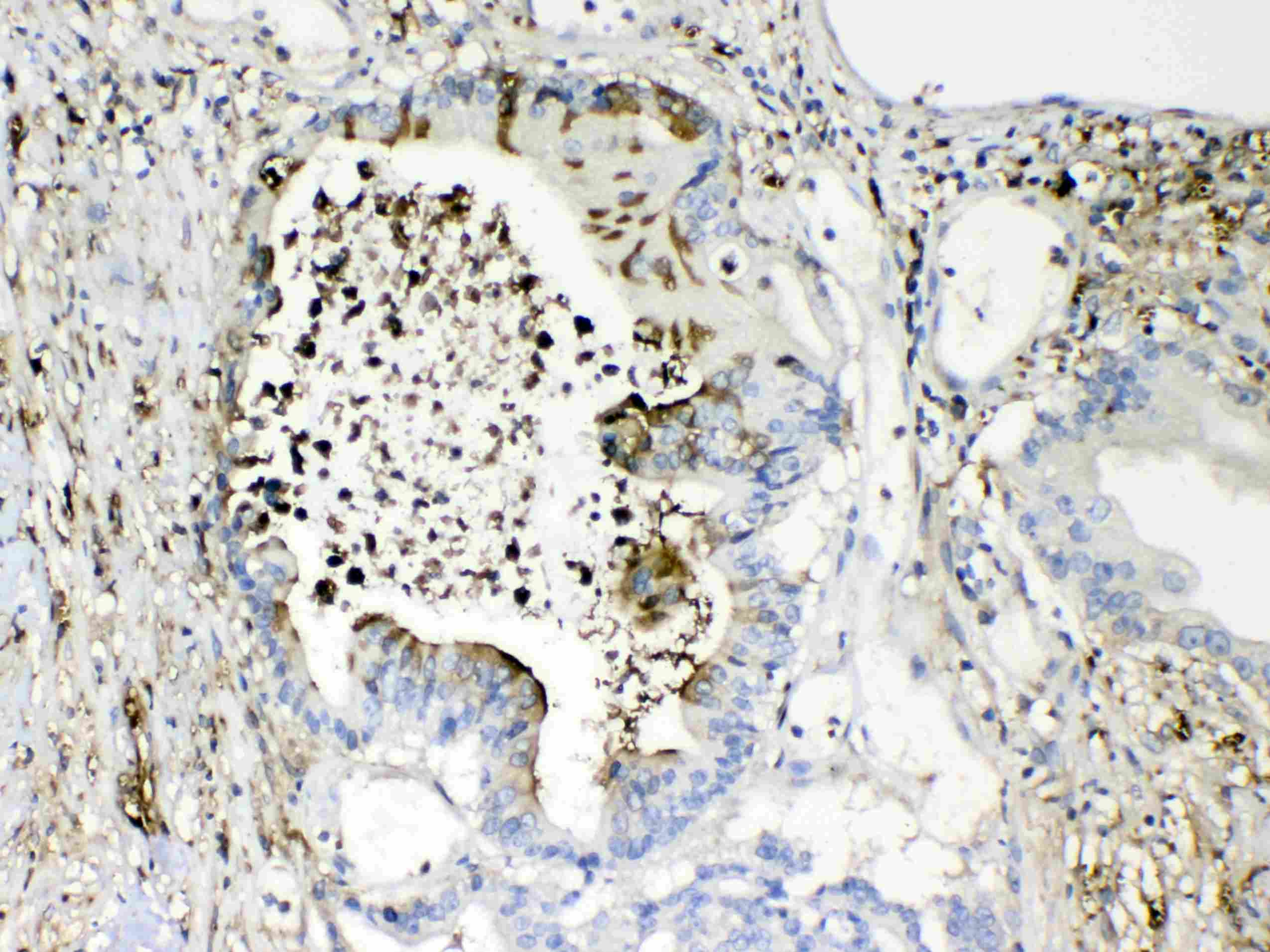 Polyclonal Rabbit anti-Human TMEM107 Antibody (IHC, WB)