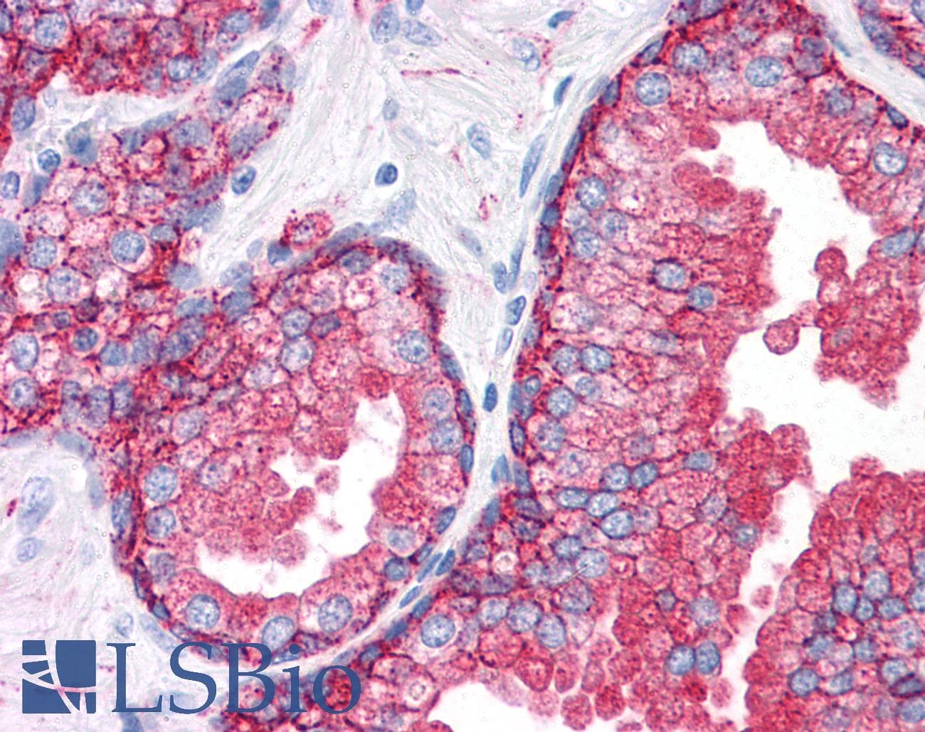 IHC-plus™ CD9 Antibody (clone SN4/C3-3A2)
