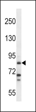 HDC / Histidine Decarboxylase Antibody (aa147-178)