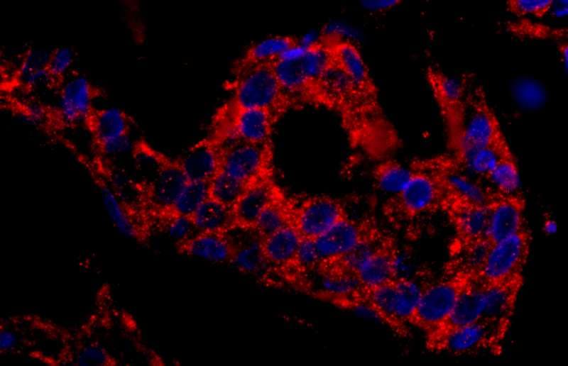 Polyclonal Rabbit anti-Human SNX1 Antibody (aa475-C-term, IHC, WB)