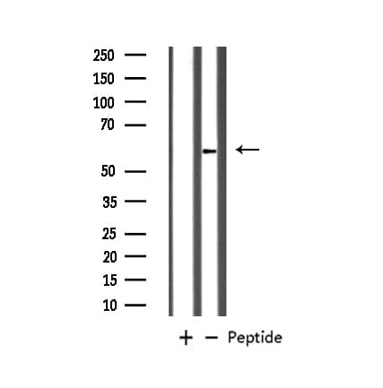 Polyclonal Rabbit anti-Human GABRB1 Antibody (IHC, IF, WB)