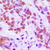 RFX3 Antibody (C-Terminus)