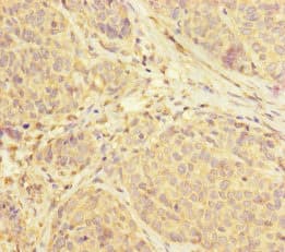 SUCLA2 Antibody