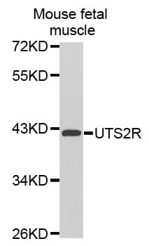 UTS2R / GPR14 Antibody