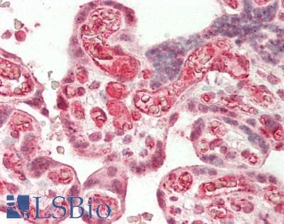 IHC-plus™ LARP7 Antibody (aa1-50)