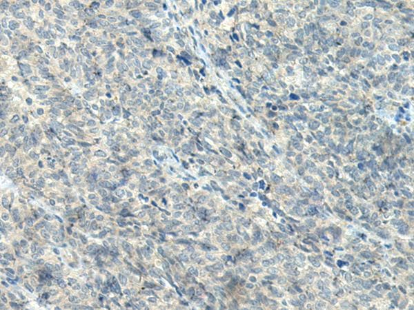 NPVF Antibody