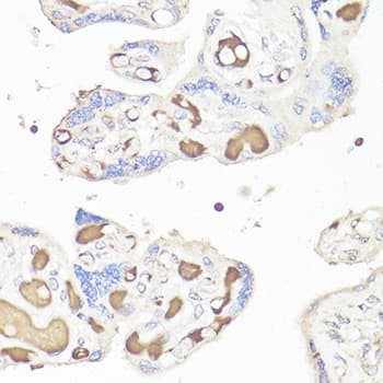IL6 / Interleukin 6 Antibody