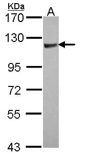 ARHGAP4 Antibody (aa1-280)