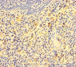 GCET2 / HGAL Antibody