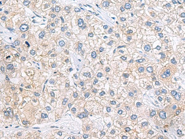Polyclonal Rabbit anti-Human Zfp105 / ZNF35 Antibody (IHC)