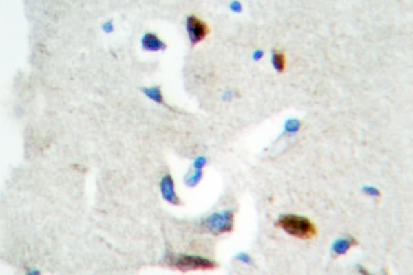 E2F1 Antibody (Asp426)