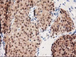 GALE / UDP-Glucose 4-Epimerase Antibody (clone OTI1C4)