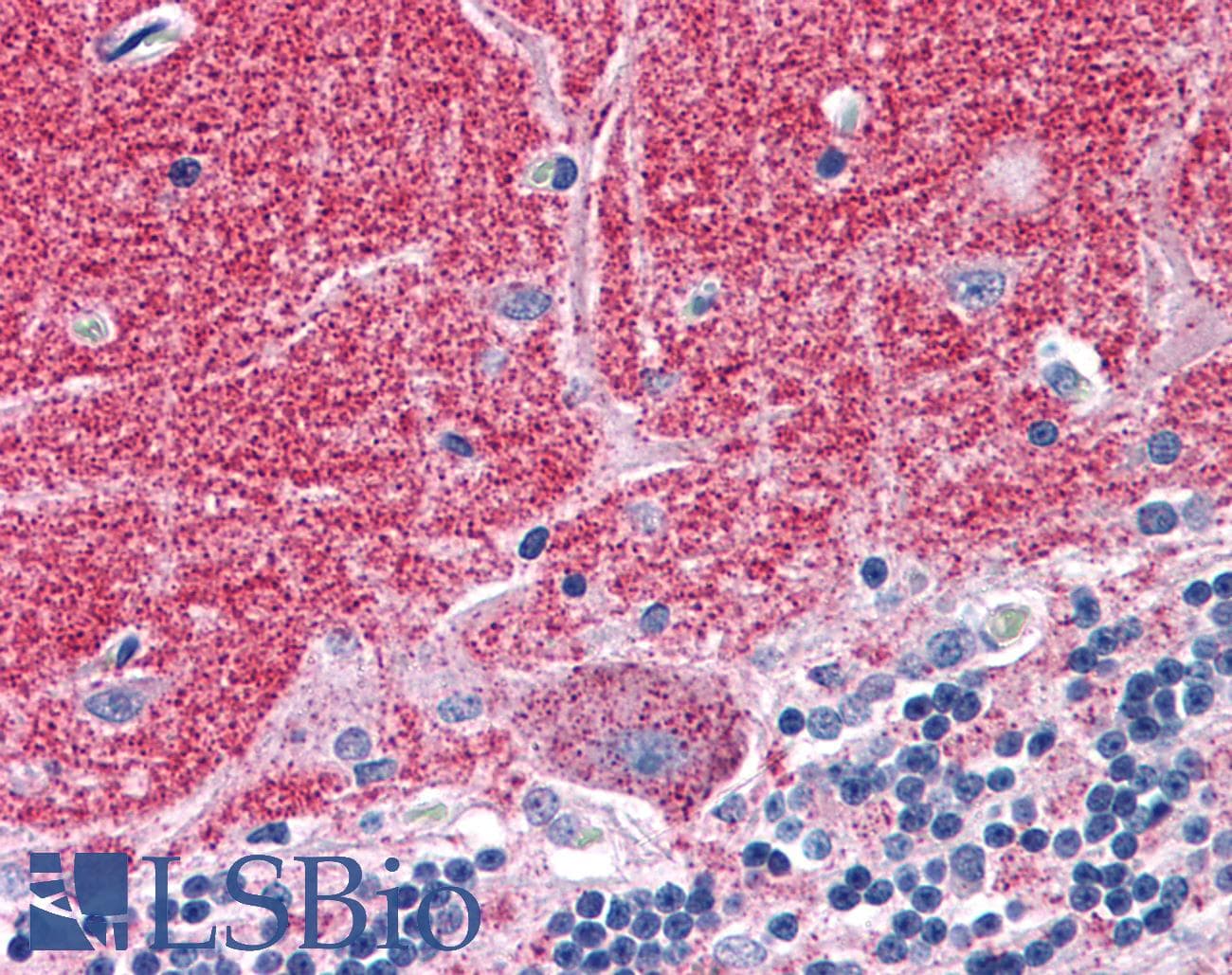 IHC-plus™ SEPT3 / Septin 3 Antibody (aa15-26)