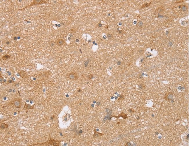 TRIM34 / RNF21 Antibody