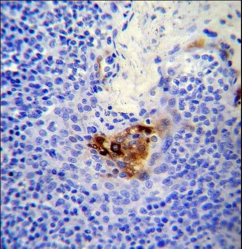 MCAM / CD146 Antibody (aa532-558)