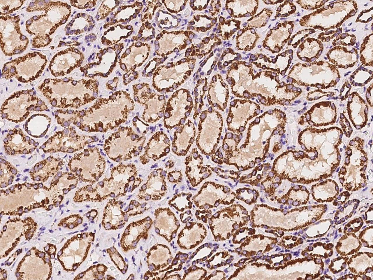 Polyclonal Rabbit anti-Human PCCB Antibody (IHC, WB)
