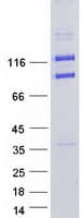 Human CLIP2 / CYLN2 Protein (Recombinant Myc-DDK (Flag))