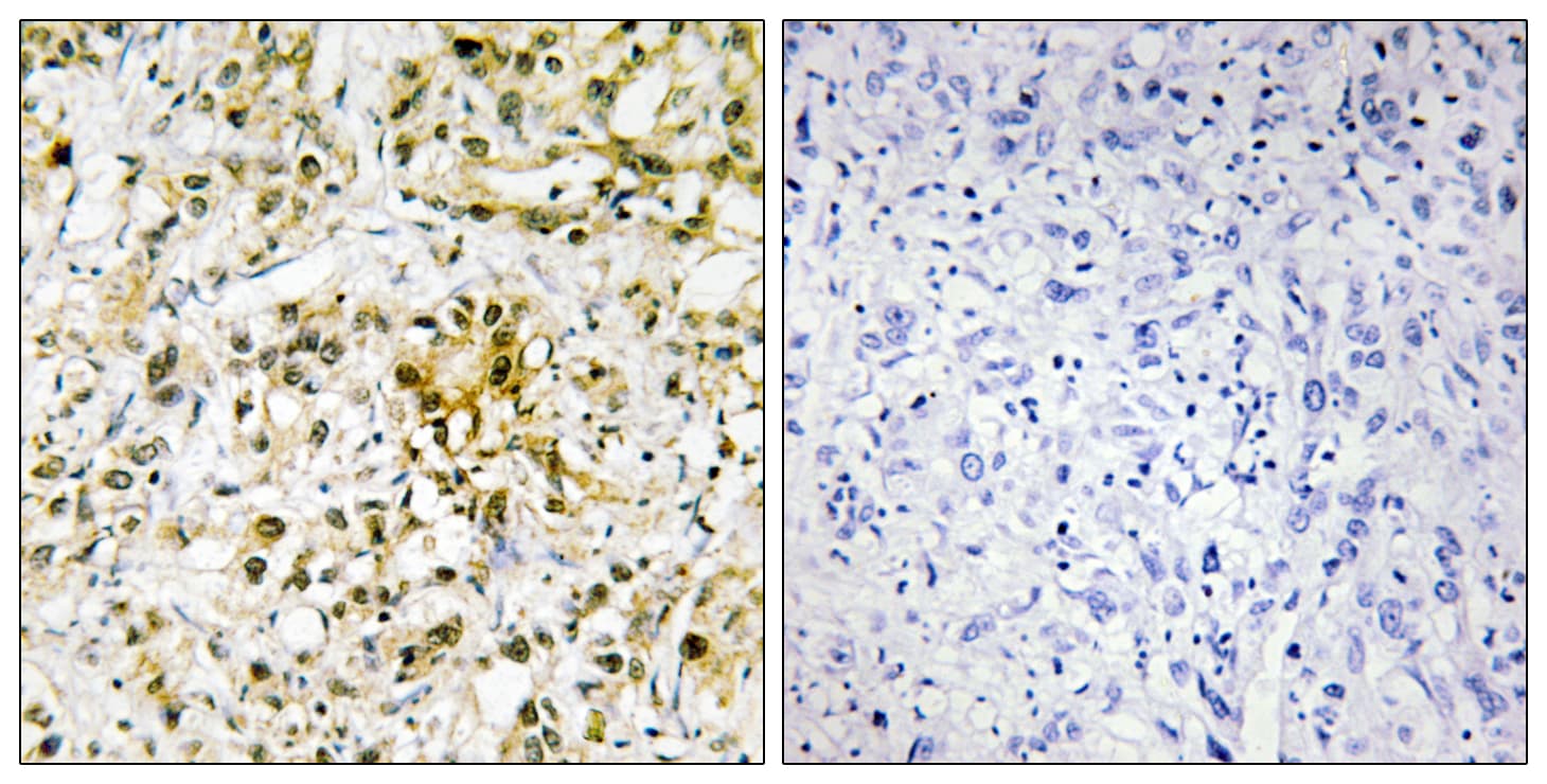 GAL4 / Galectin 4 Antibody (aa61-110)
