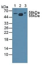 ANTXR2 / CMG2 Antibody (aa34-318, PE)