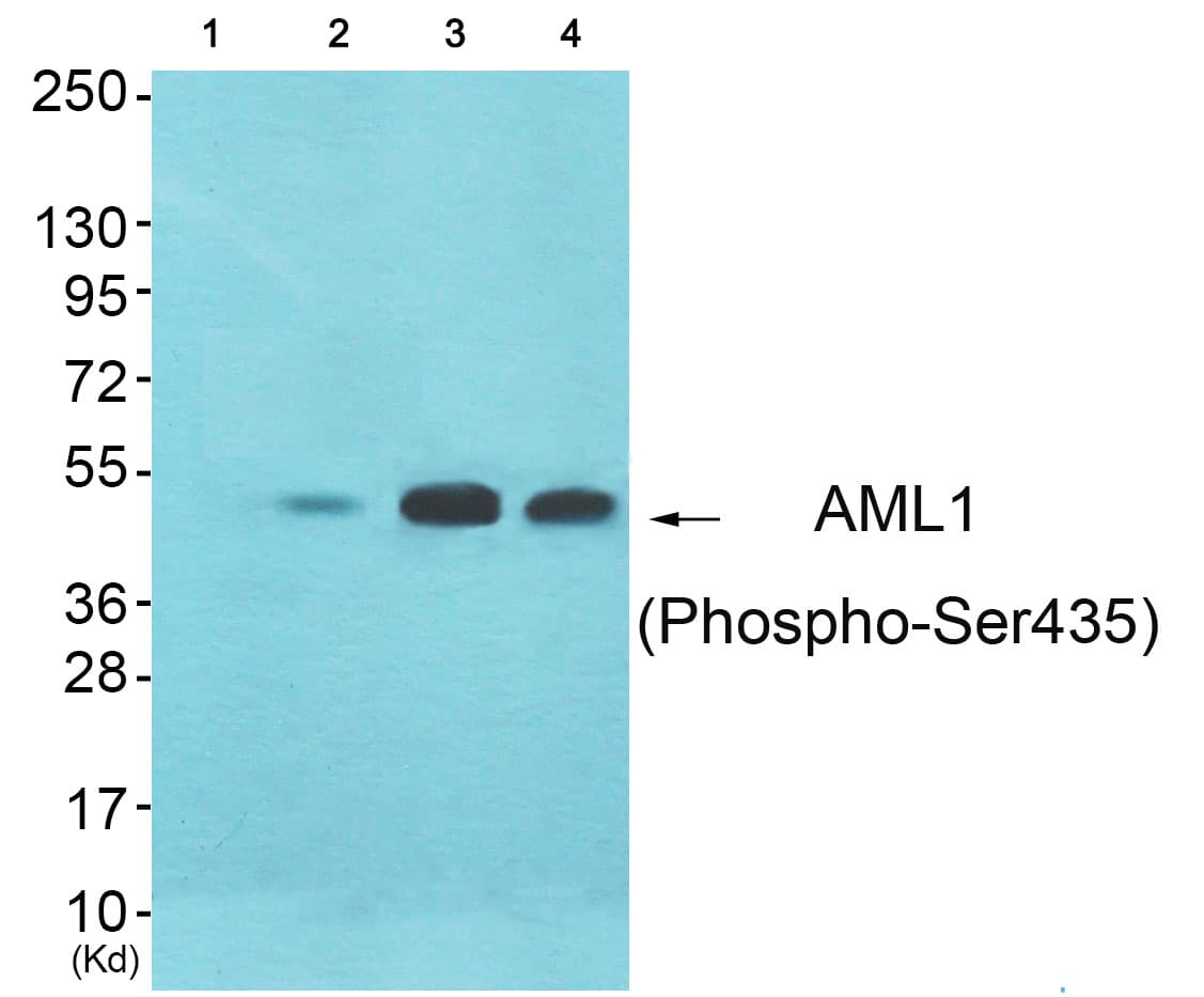 AML1 / RUNX1 Antibody (phospho-Ser435)